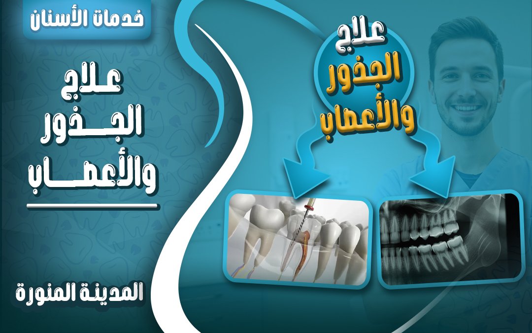 علاج الجذور