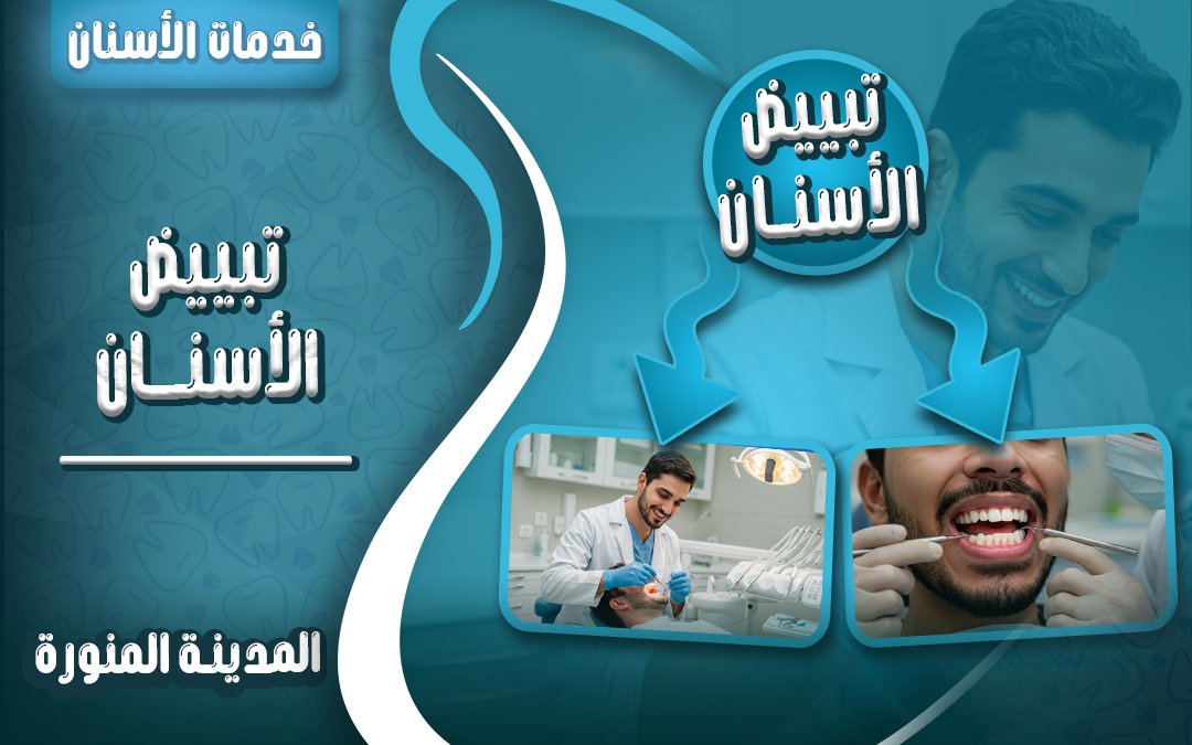 تبييض الأسنان