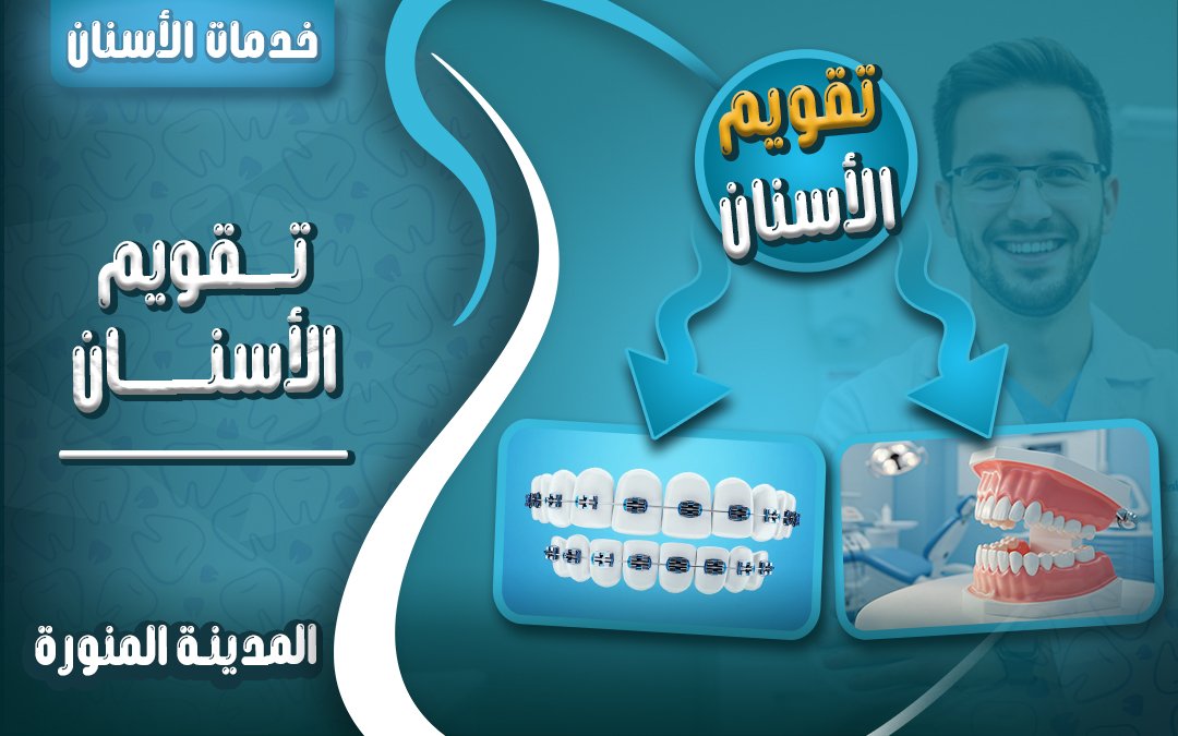 تقويم الأسنان