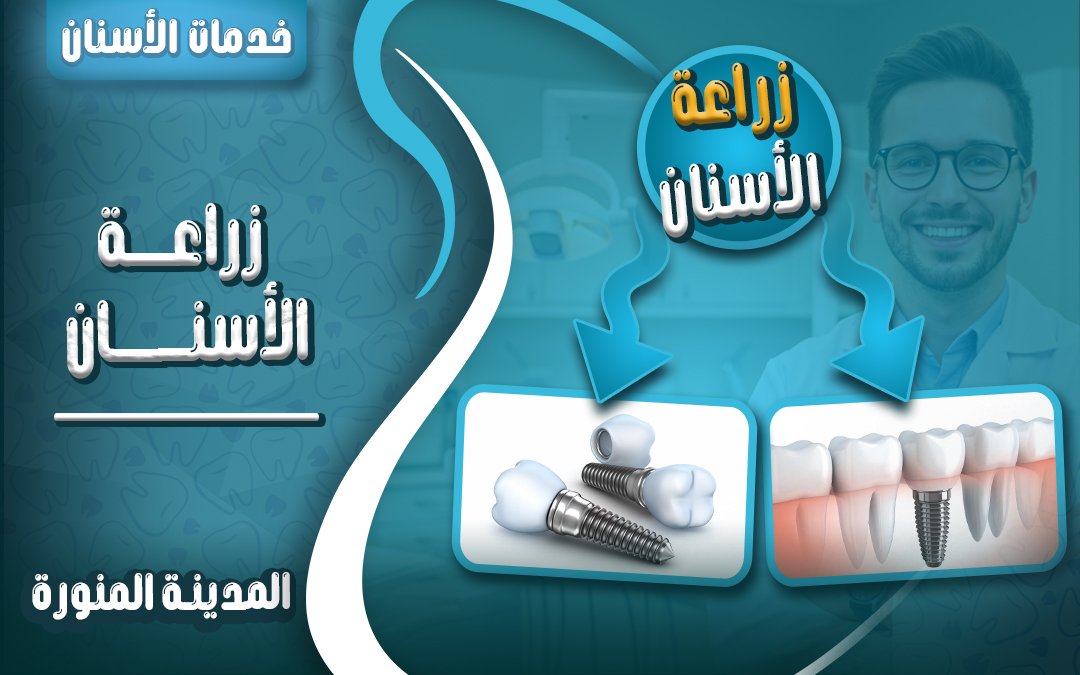 زراعة الأسنان