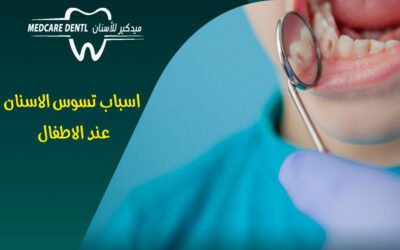 اسباب تسوس الاسنان عند الاطفال | طرق إزالة و علاج التسوس