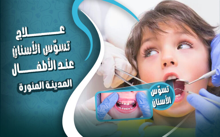 دكتور علاج تسوس أسنان اللبنية عند الأطفال بعمر سنتين بالمدينة المنورة