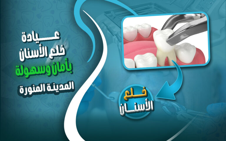 احسن دكتور خلع اسنان بالمدينة المنورة