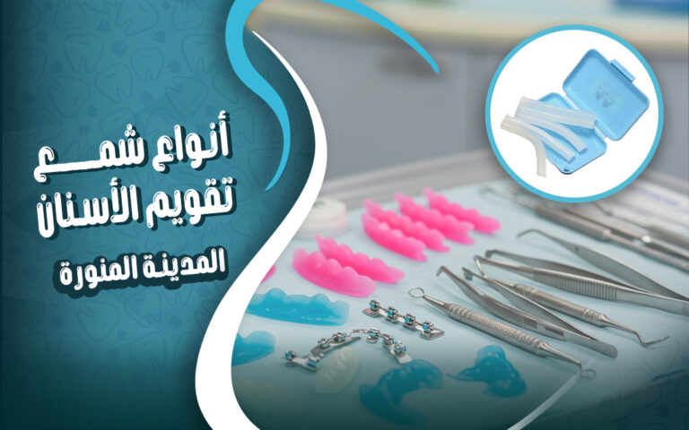 سعر و انواع شمع تقويم الاسنان و مدة استخدامه