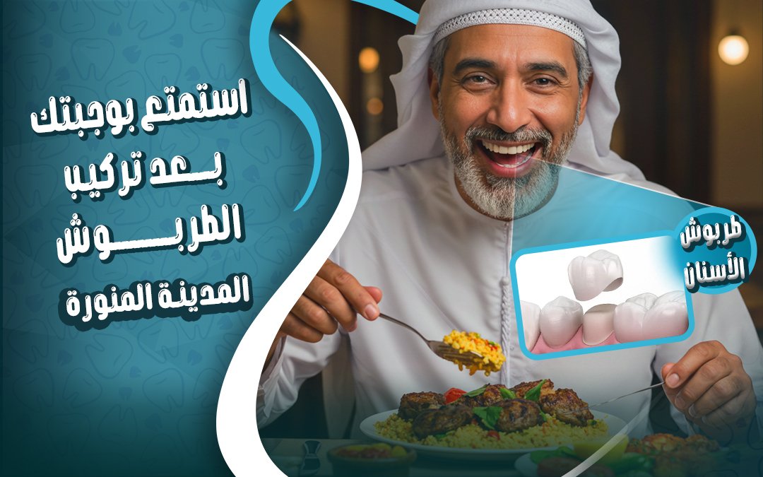 الاكل بعد تركيب الطربوش للأسنان