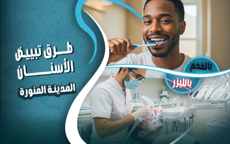 افضل دكتور تبييض الاسنان بالليزر في المدينة المنورة