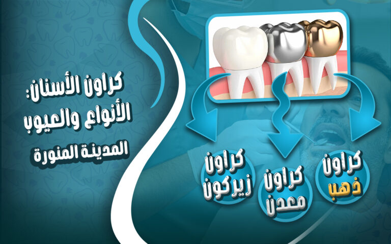 دكتور تركيب كراون الاسنان بالمدينة المنورة