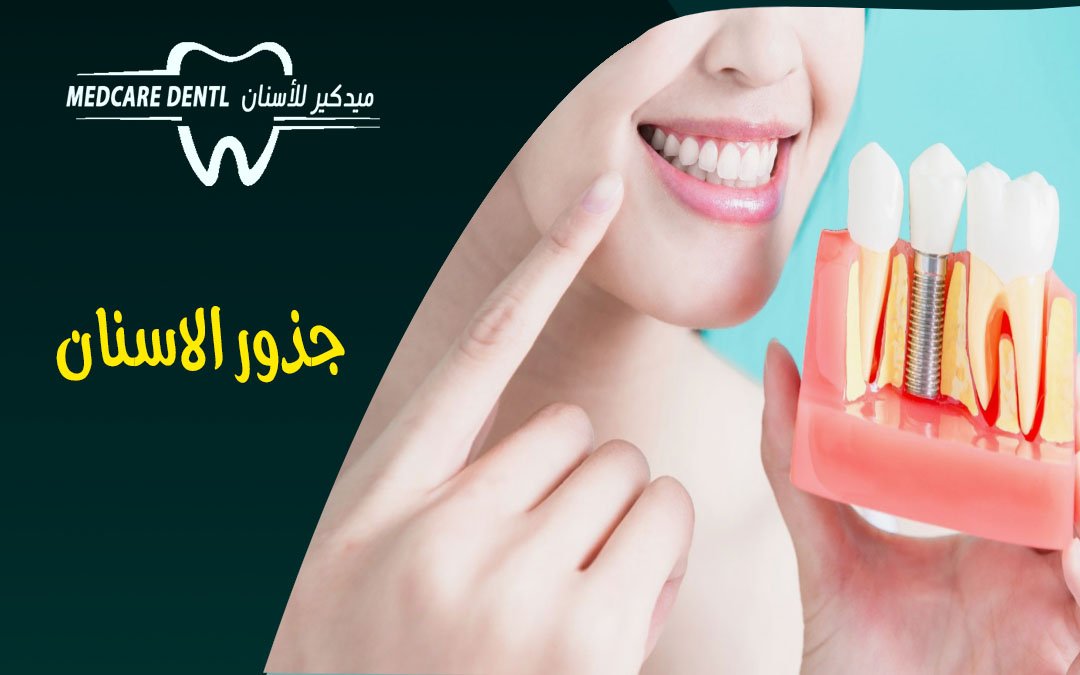 اسعار علاج جذور الاسنان وكيفية إجرائه بالمدينة المنورة