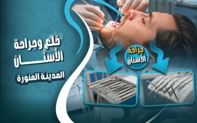 خلع و جراحة الأسنان