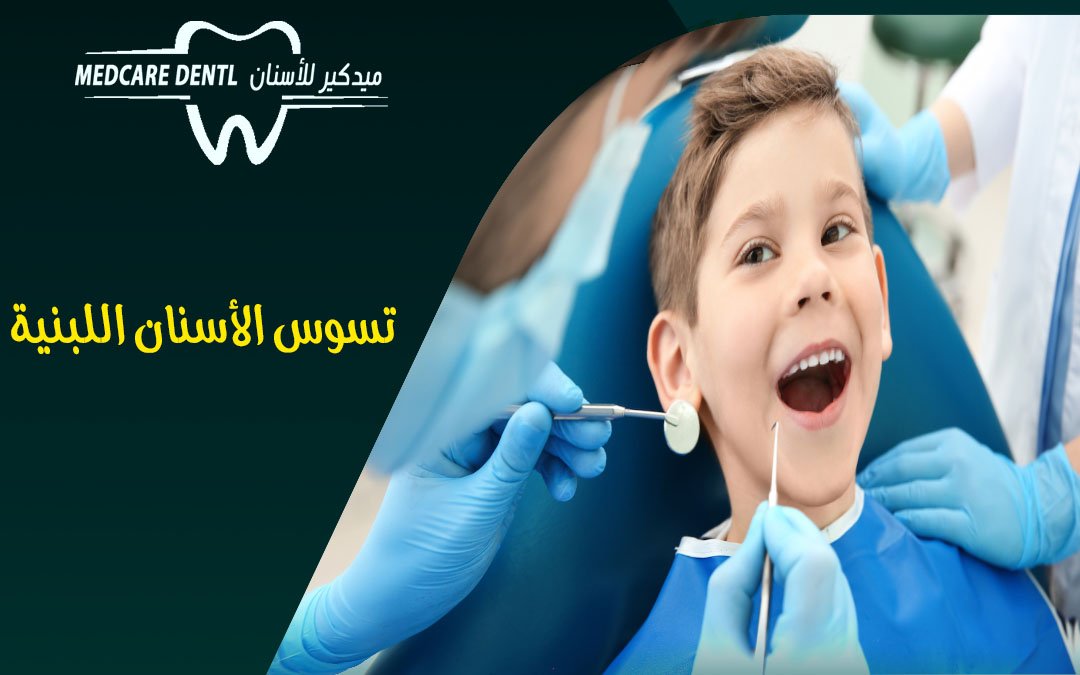علاج تسوس الأسنان اللبنية عند الأطفال بعمر سنتين و الرضع