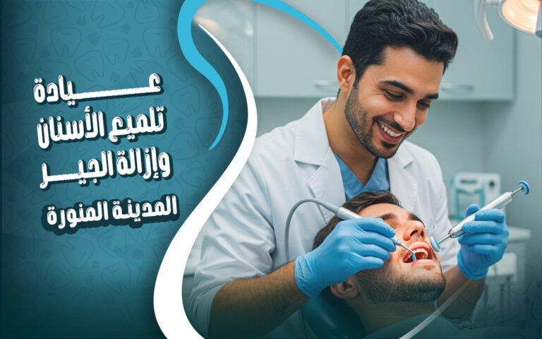 عيادة تلميع و إزالة الجير من الاسنان بالمدينة المنورة