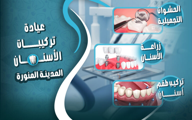 عيادة تركيبات الأسنان في المدينة المنورة