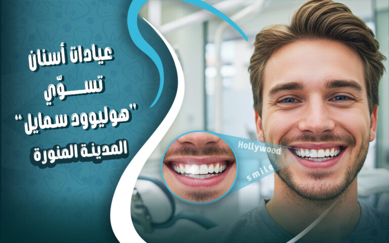 عيادات طب الاسنان بالمدينة المنورة تسوي ابتسامة هوليود