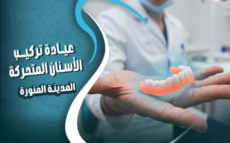 عيادة تركيب اسنان متحركة بالمدينة المنورة