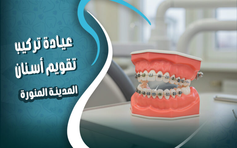 عيادة تركيب تقويم الاسنان في المدينة المنورة